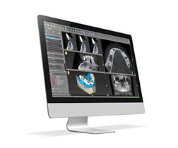 Программное обеспечение для хирургического планирования coDiagnostiX® CDX